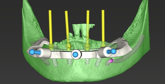 digial-3