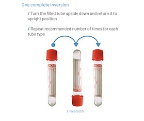 inversion-tube-small