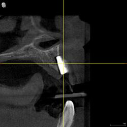 DRIES_3D examination(1)_Volume_20260527_081712_Cross-sectional