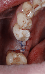 截屏2026-01-25 11.14.44