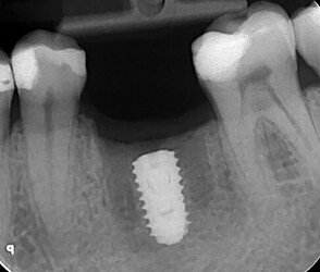 截屏2026-01-25 11.18.36