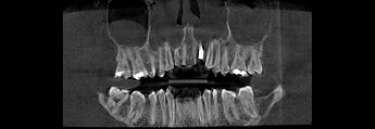 DRIES_3D examination(1)_Volume_20260527_081712_Panorama(1)