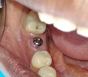 1000398464