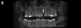 DRIES_3D examination(1)_Volume_20260527_081712_Panorama