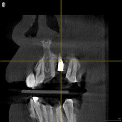 DRIES_3D examination(1)_Volume_20260527_081712_Longitudinal