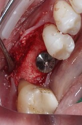 截屏2026-01-25 11.20.25