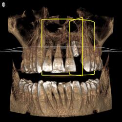 DRIES_3D examination(1)_Volume_20260527_081712_3D