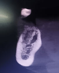 1000935353