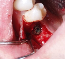 截屏2026-01-25 11.19.09