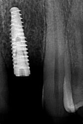 DRIES_Light box(1)_Intraoral_20260529_101644