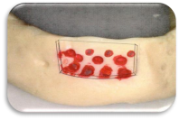 Osteogen Bone Block Figure 1