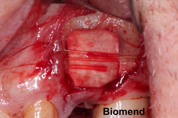 Do you like your Membrane Stiff or Flexible? 2