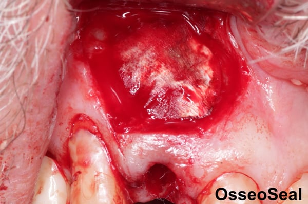 Do you like your Membrane Stiff or Flexible? 1