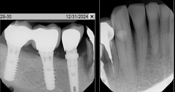 How would you graft this case?